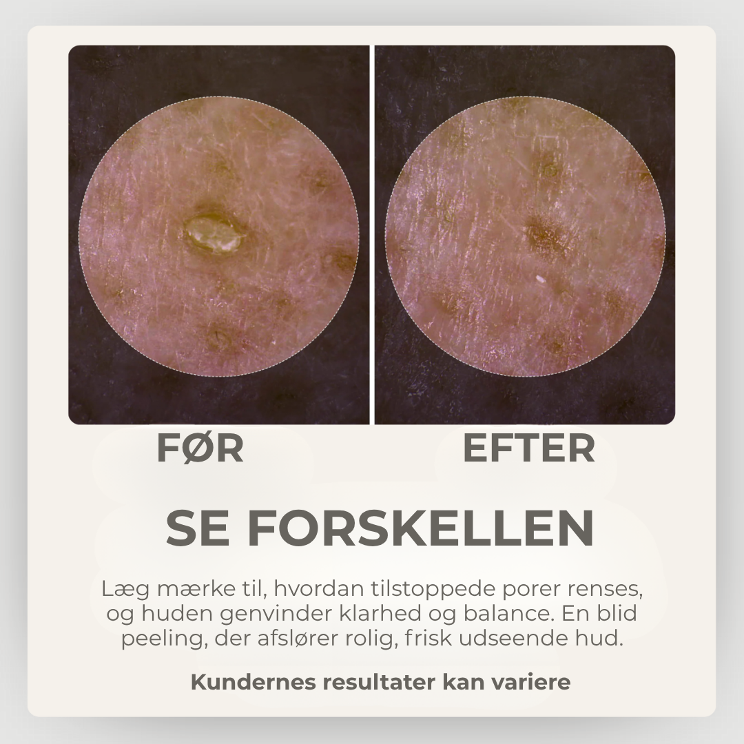 StrålendeHud® | Sig Farvel til Urenheder – Hej til Strålende Hud!
