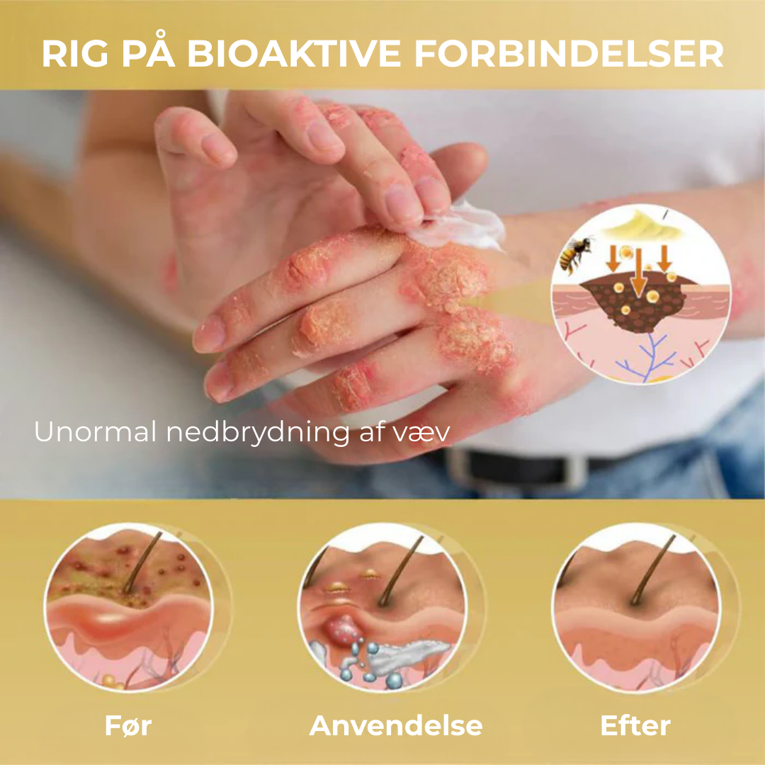 VitaBee® | Koncentreret bigift reparationscreme