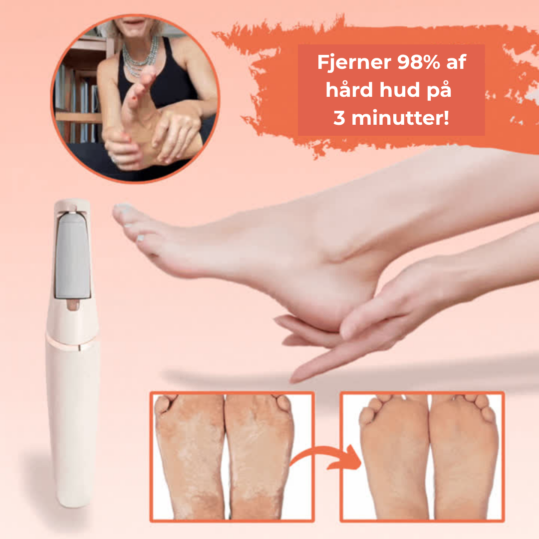 SilkSteps® | Øjeblikkelig hård hudfjerner til babybløde fødder