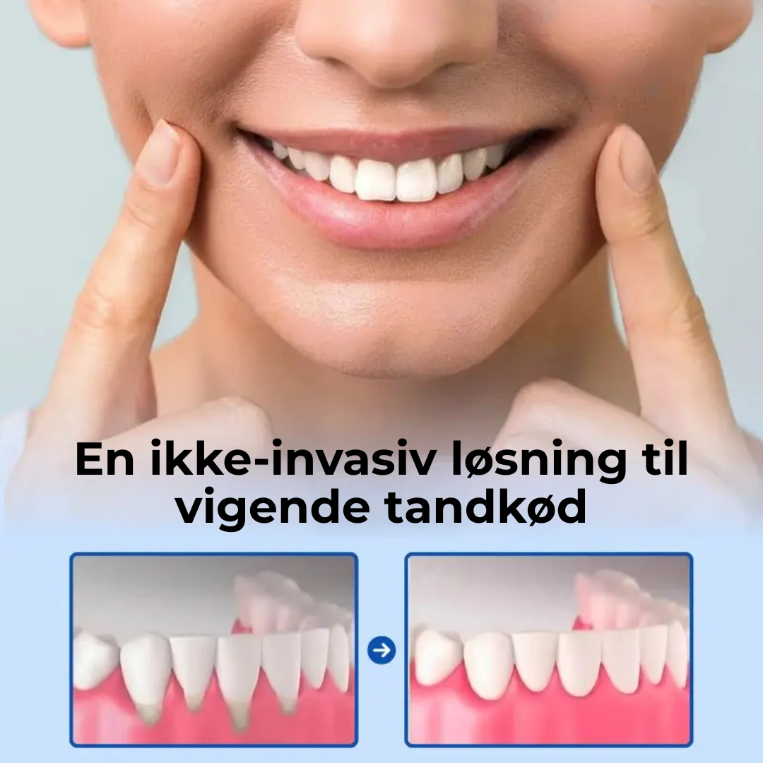 TandRo® | Stop tandkøbsretraktion naturligt, smertefrit og på kun 3 dage!