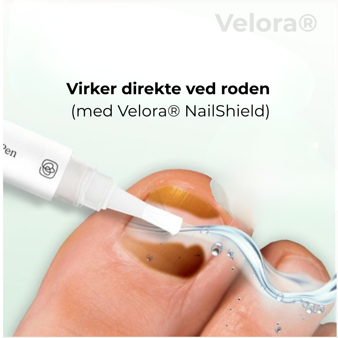 Velora® Negleskjold | Den naturlige løsning til stærke, sunde og svampefri negle!