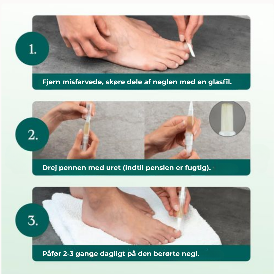 Velora® Negleskjold | Den naturlige løsning til stærke, sunde og svampefri negle!