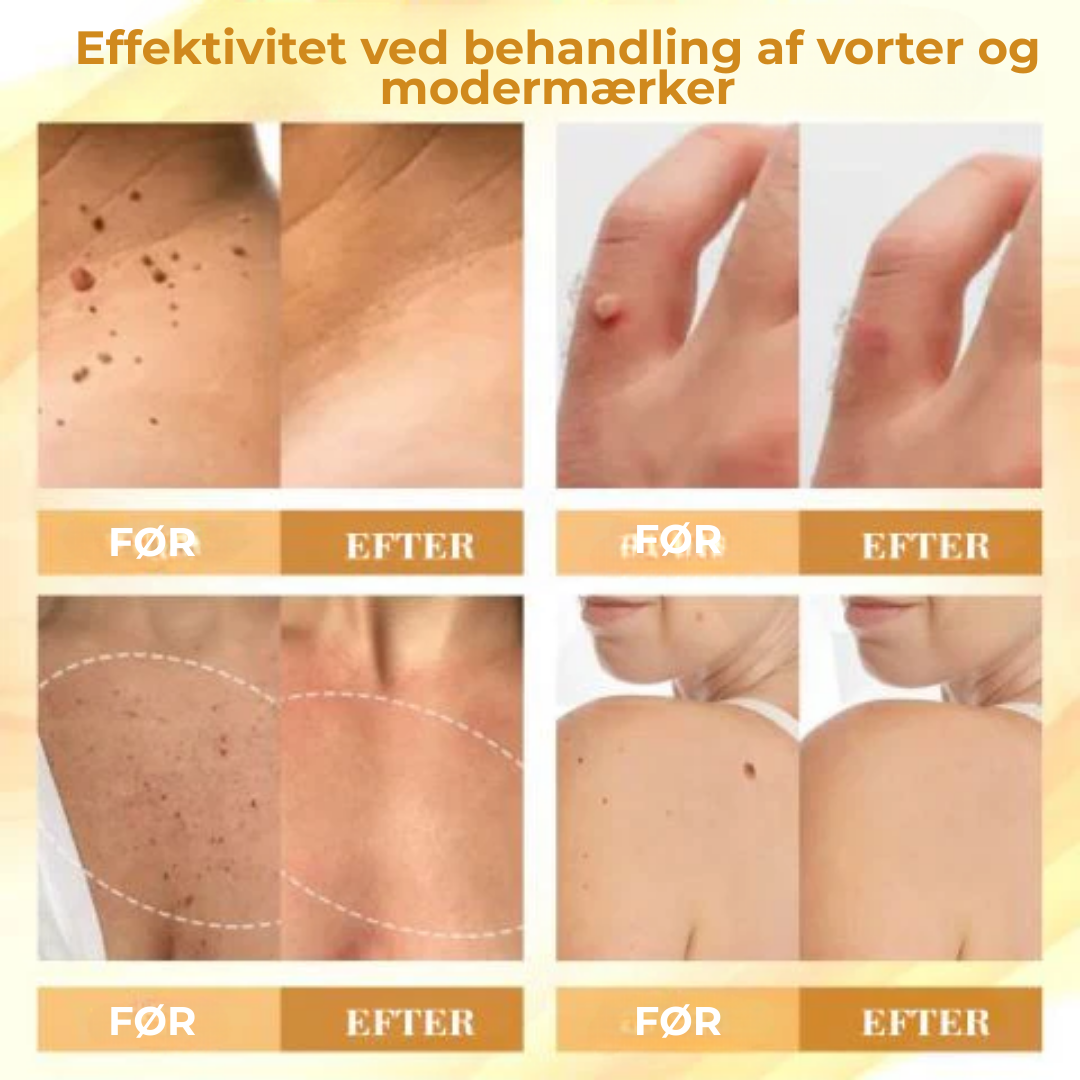 VitaBee® | Koncentreret bigift reparationscreme