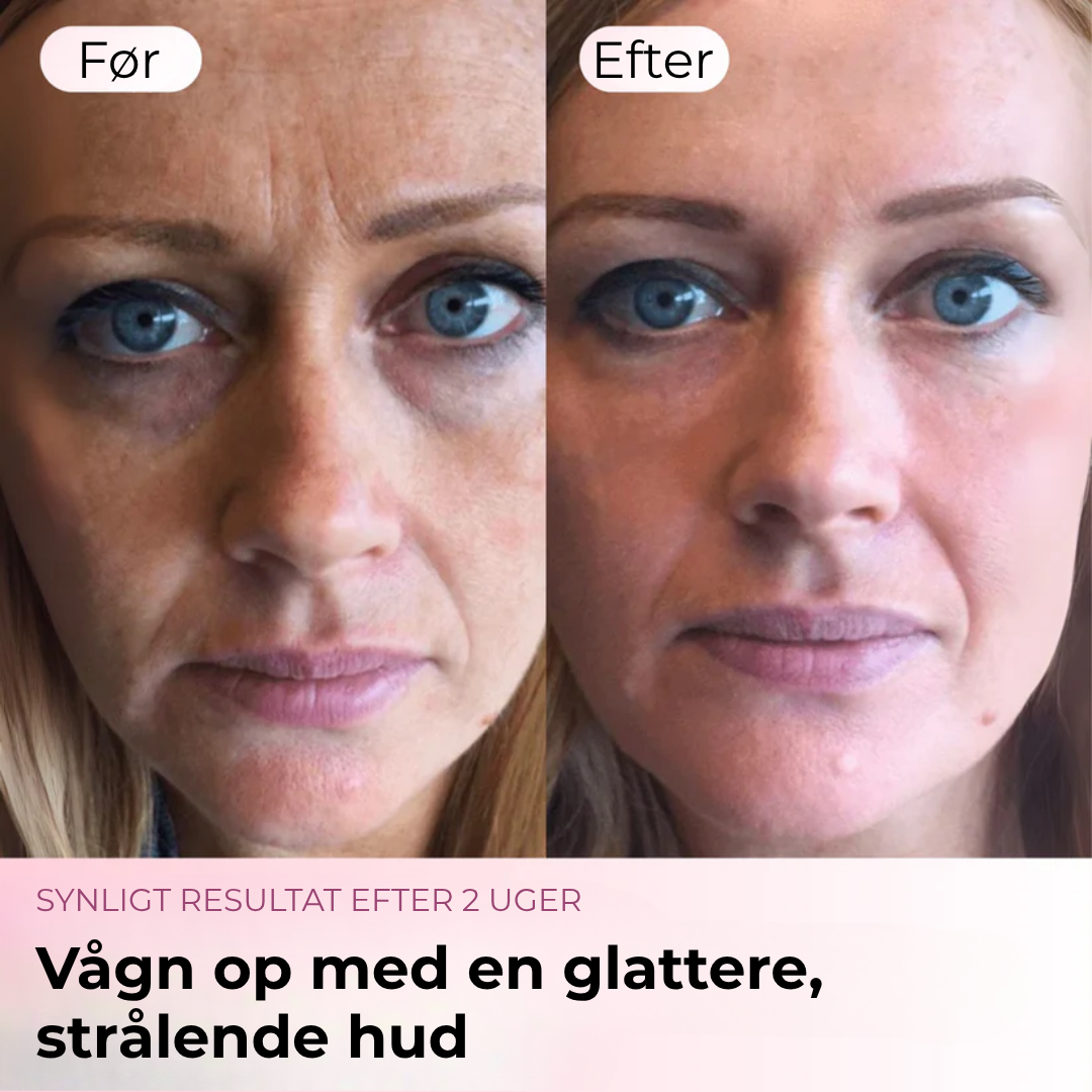 SkønAura® | Bio-Collagen Maske + Børste.
