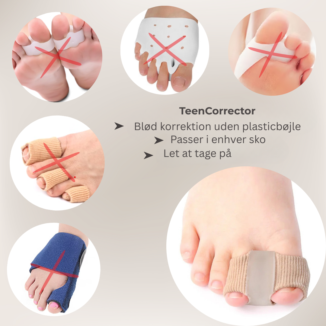 FlexiToe® | Skånsom tåjustering for daglig lindring