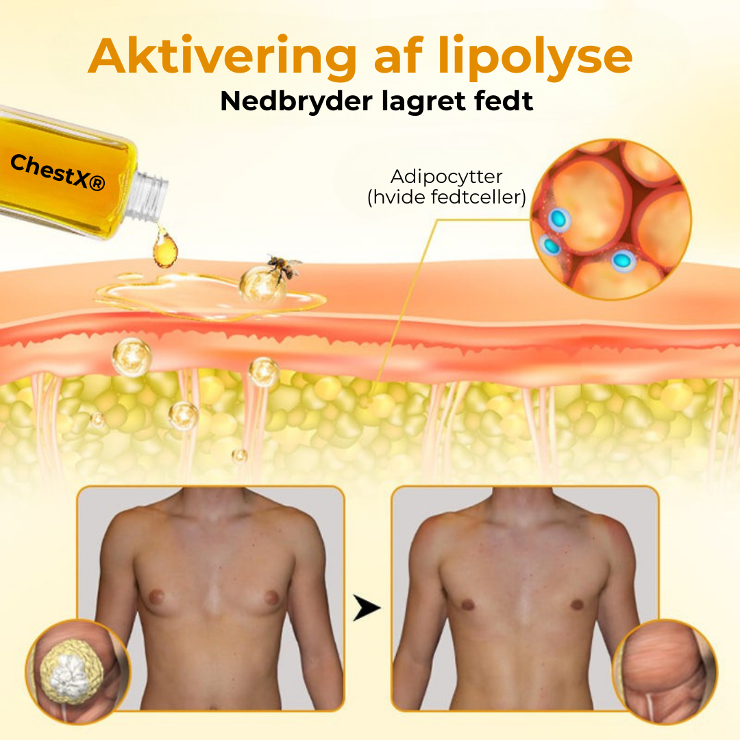 ChestX® Chest Redefiner | Venom Oil til behandling af gynækomasti