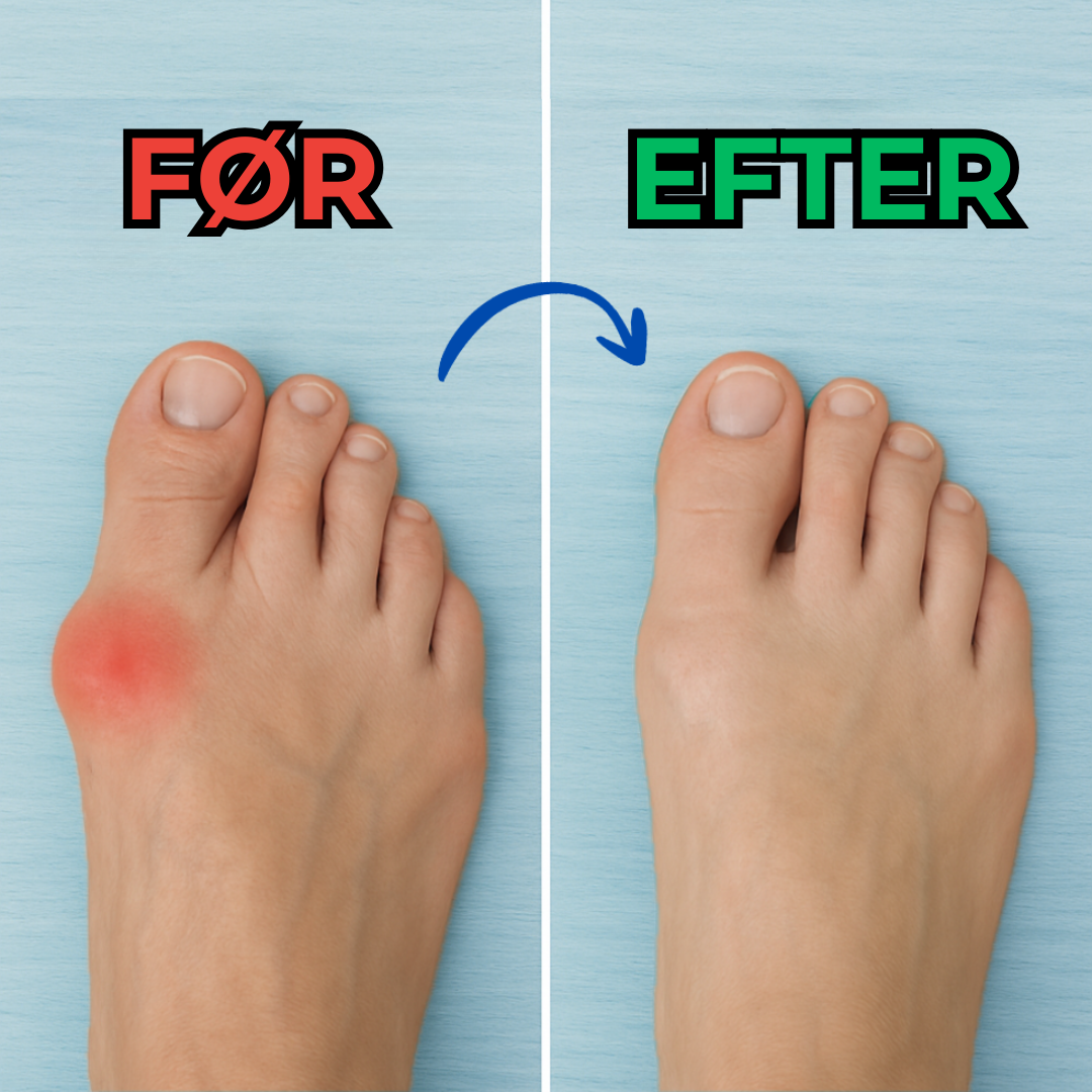 Orthovell® | Lindre dine fødder i dag, uden aftale eller medicin