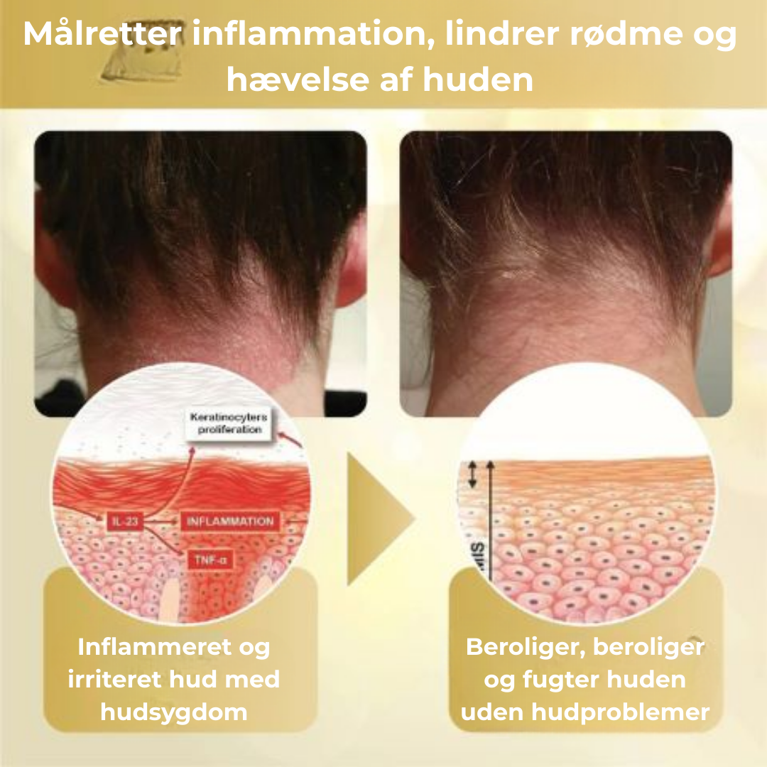 VitaBee® | Koncentreret bigift reparationscreme