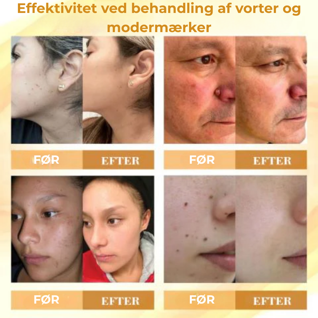 VitaBee® | Koncentreret bigift reparationscreme