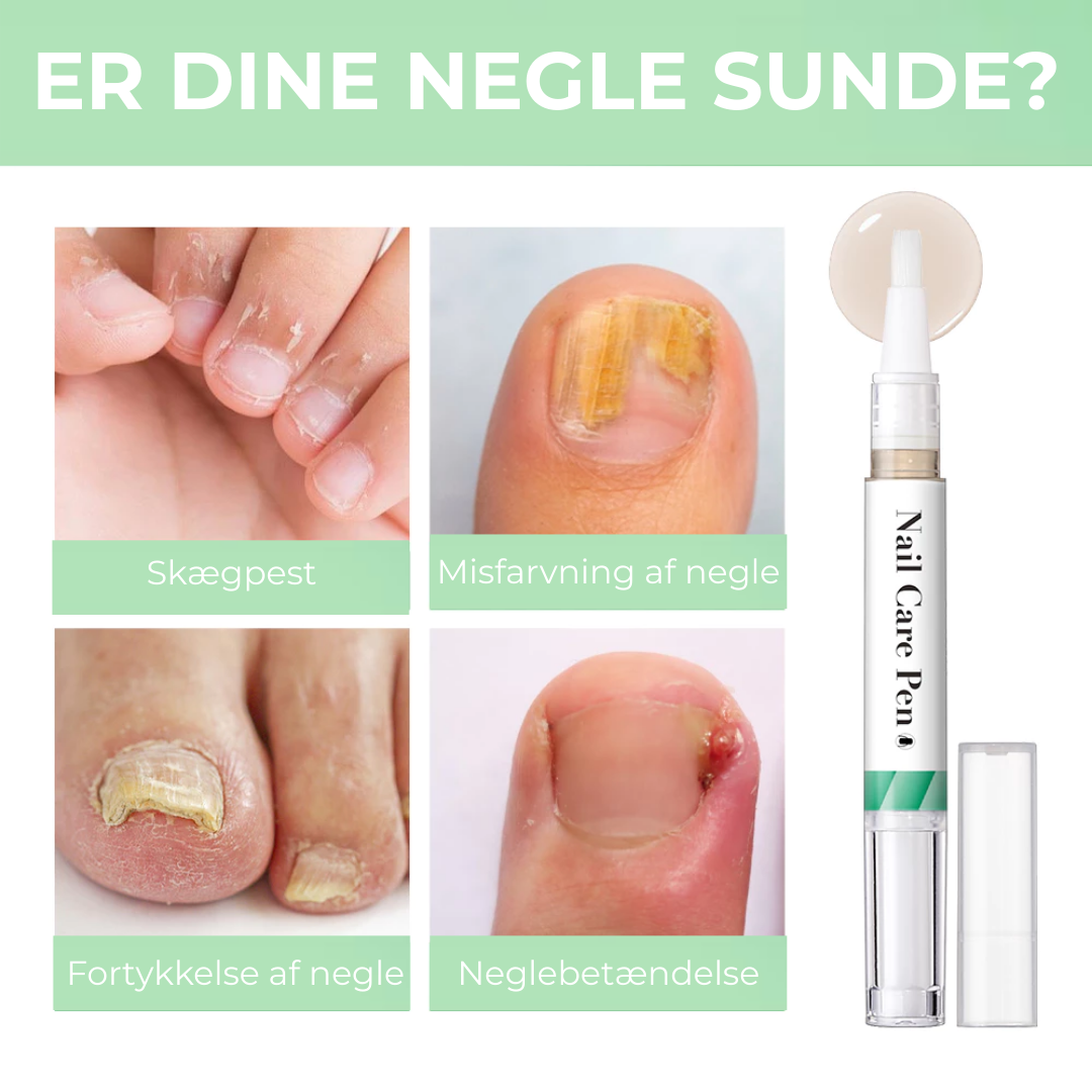 Velora® Negleskjold | Den naturlige løsning til stærke, sunde og svampefri negle!