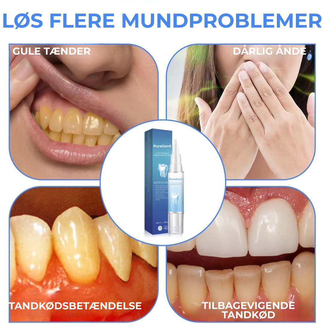 PuraGen® | Sundere tandkød og op til 95 % hvidere tænder på bare 3 dage!