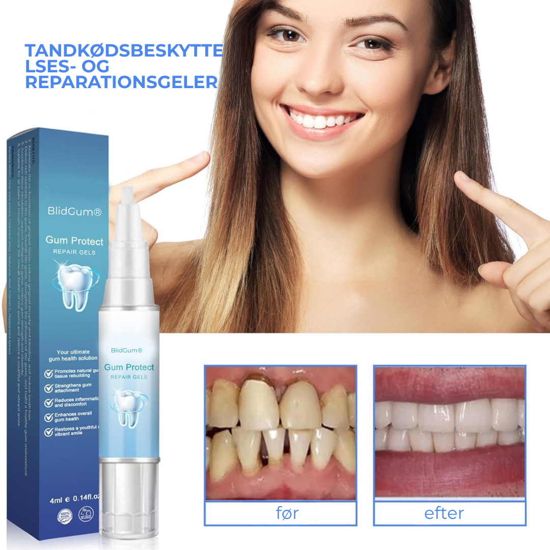 BlidGum® | Revitaliserer tilbagetrukket tandkød og hvidner gule tænder på kun 3 dage