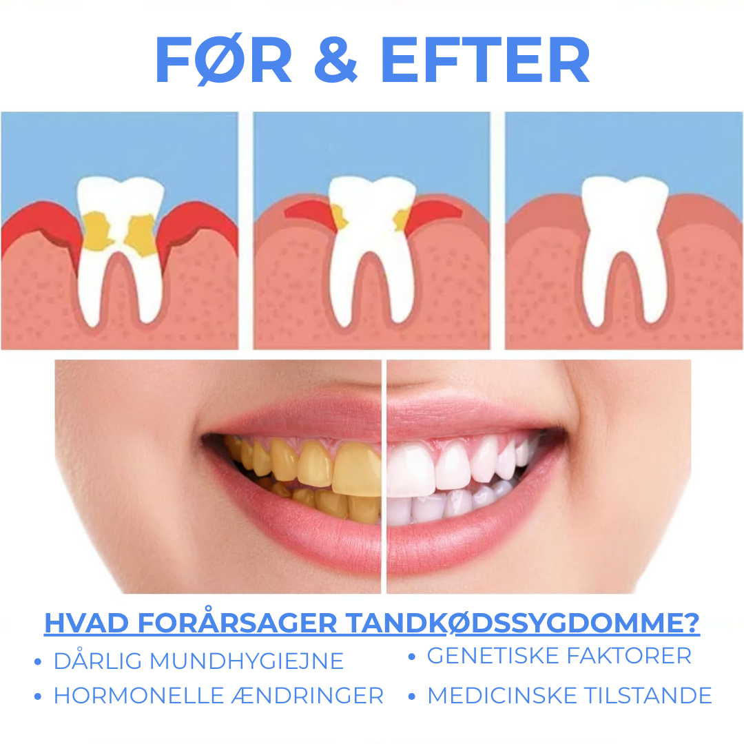 PuraGen® | Sundere tandkød og op til 95 % hvidere tænder på bare 3 dage!