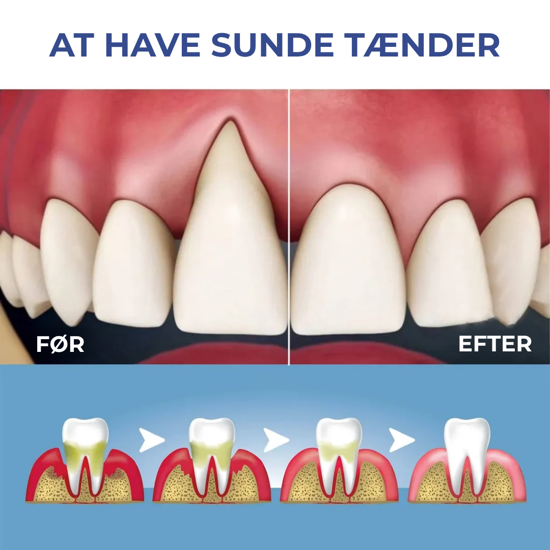 BlidGum® | Revitaliserer tilbagetrukket tandkød og hvidner gule tænder på kun 3 dage