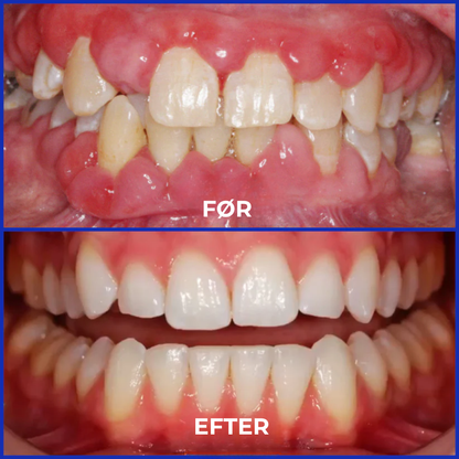 BioSmil® | Bienegift Tandterapi Oral Power