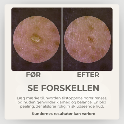 StrålendeHud® | Sig Farvel til Urenheder – Hej til Strålende Hud!