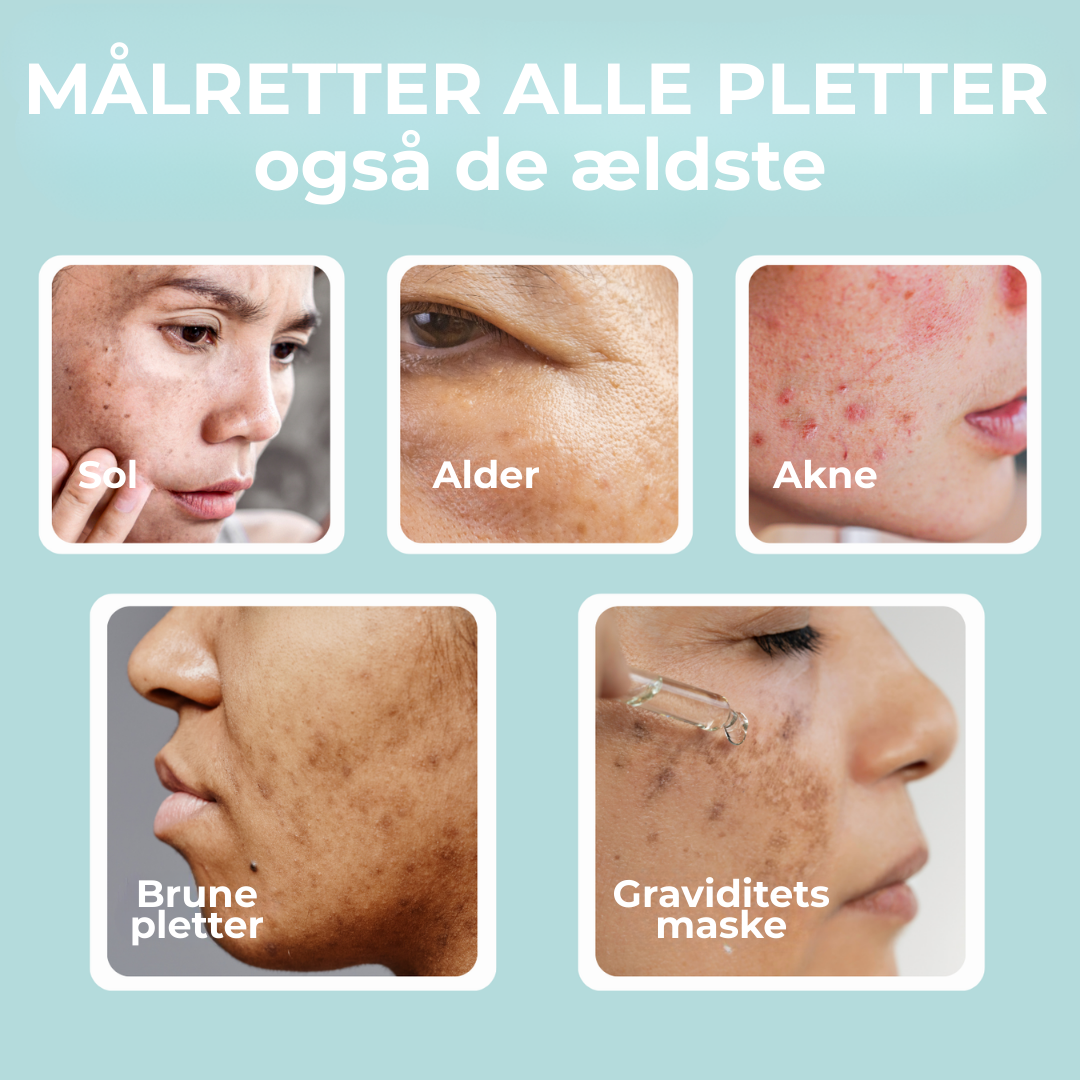 RenGlød® | Anti-Mørkeplet Creme