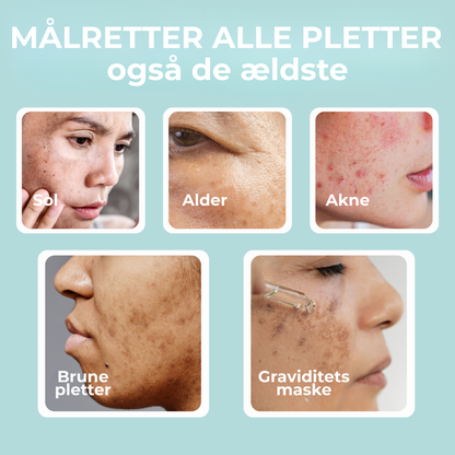 RenGlød® | Anti-Mørkeplet Creme