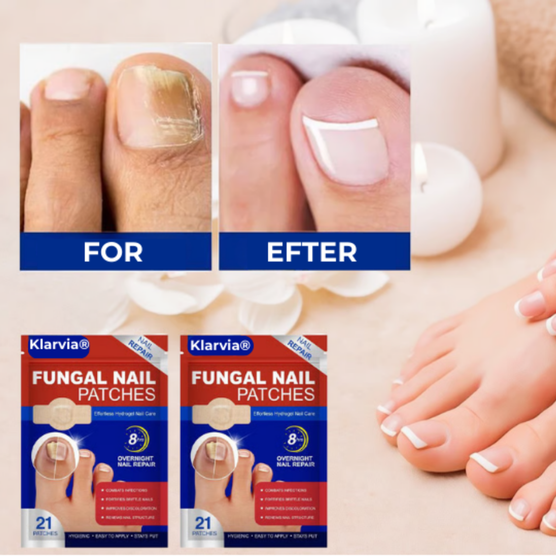 Klarvia® | Slip af med neglesvamp for altid – se resultater på kun 2 uger!