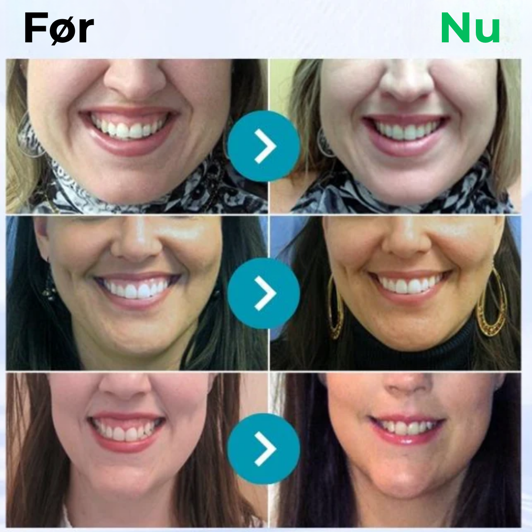 BioSmil® | Bienegift Tandterapi Oral Power