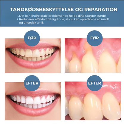 BlidGum® | Revitaliserer tilbagetrukket tandkød og hvidner gule tænder på kun 3 dage