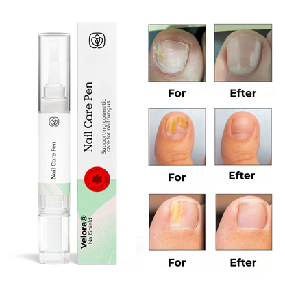 Velora® Negleskjold | Den naturlige løsning til stærke, sunde og svampefri negle!