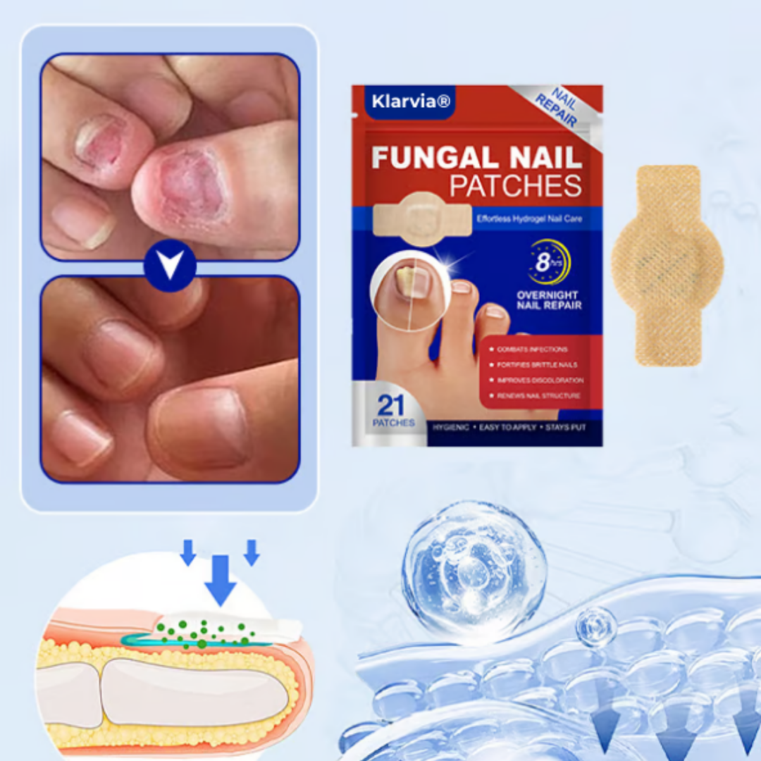 Klarvia® | Slip af med neglesvamp for altid – se resultater på kun 2 uger!