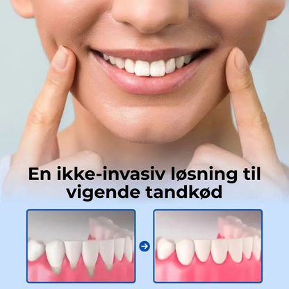 TandRo® | Stop tandkøbsretraktion naturligt, smertefrit og på kun 3 dage!