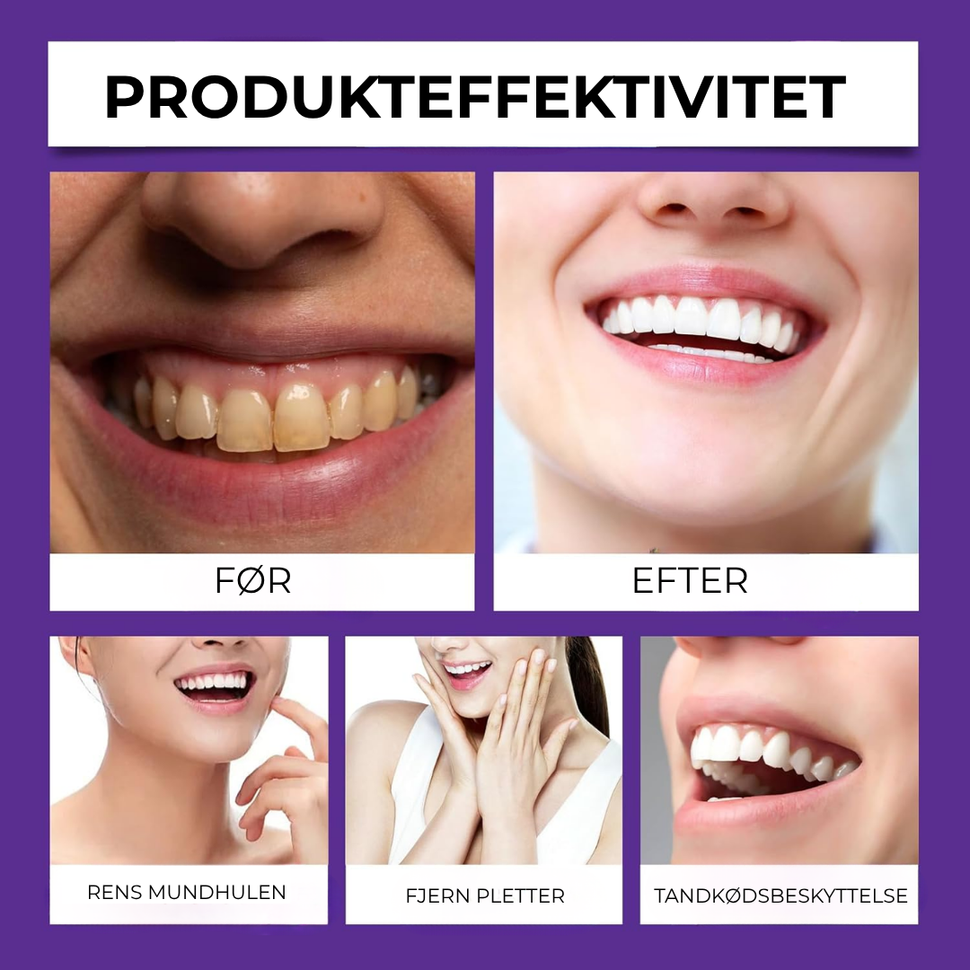 BioSmil® | Bienegift Tandterapi Oral Power