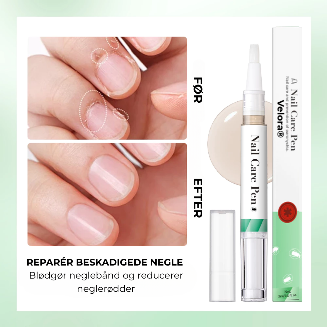 Velora® Negleskjold | Den naturlige løsning til stærke, sunde og svampefri negle!