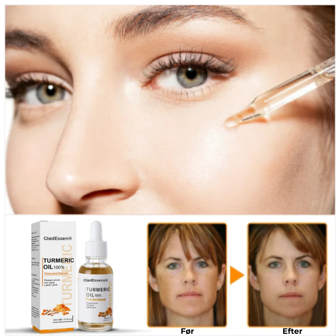 GlødEssens® Serum mod Mørke Pletter