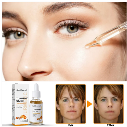 GlødEssens® Serum mod Mørke Pletter