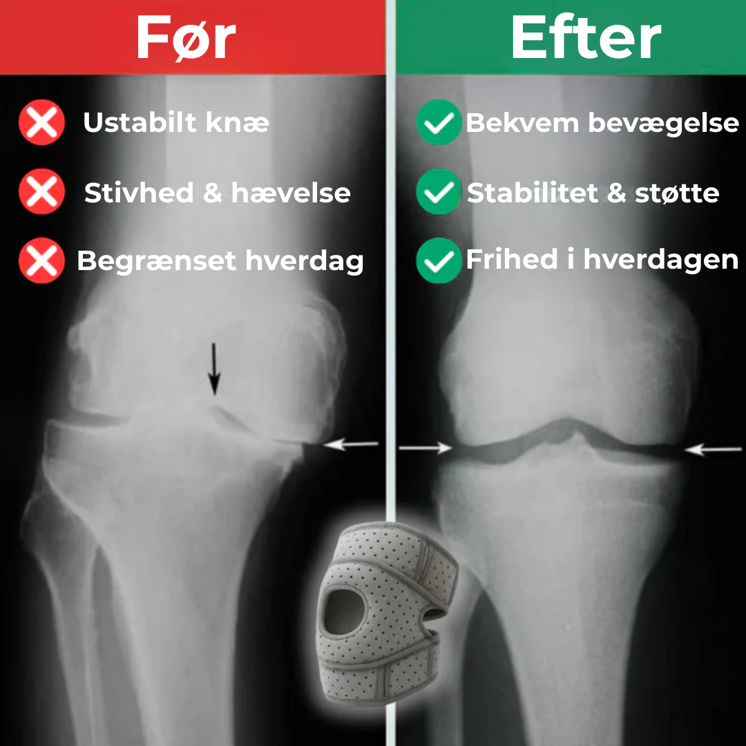 KnæStøtte Pro® | Sig Farvel til Knæsmerter – Genvind Din Hverdag