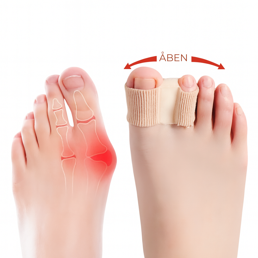 FlexiToe® | Skånsom tåjustering for daglig lindring