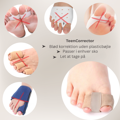 FlexiToe® | Skånsom tåjustering for daglig lindring