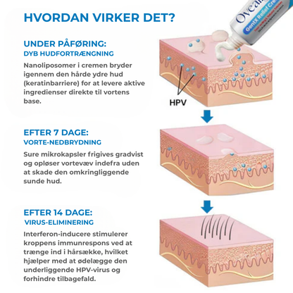 Skinsera® HPV Genital Warts Relief Cream