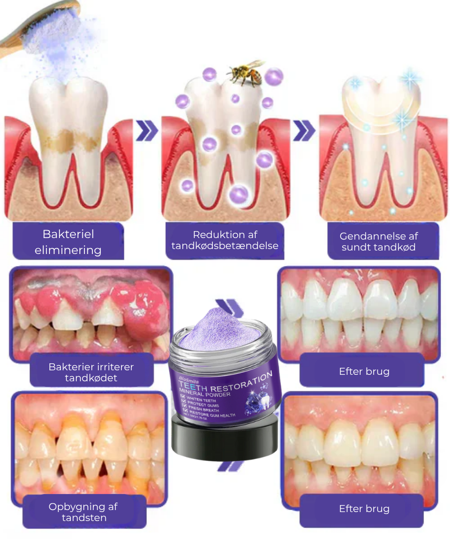 BioSmil® | Bienegift Tandterapi Oral Power