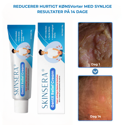 Skinsera® HPV Genital Warts Relief Cream