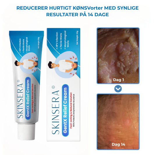 Skinsera® HPV Genital Warts Relief Cream