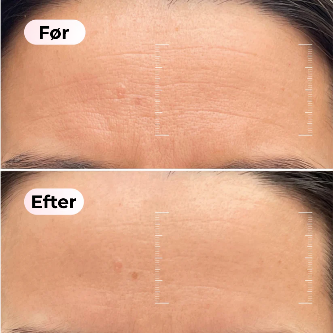 SkønAura® | Bio-Collagen Maske + Børste.