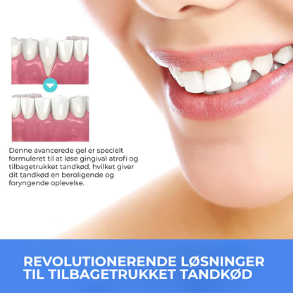 BlidGum® | Revitaliserer tilbagetrukket tandkød og hvidner gule tænder på kun 3 dage