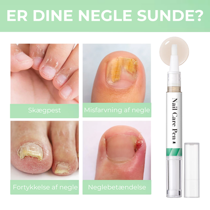 Velora® Negleskjold | Den naturlige løsning til stærke, sunde og svampefri negle!