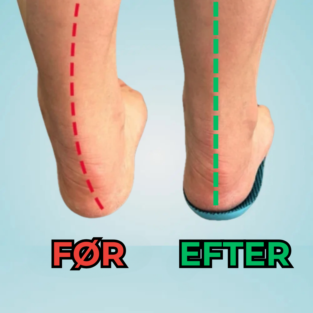 Orthovell® | Lindre dine fødder i dag, uden aftale eller medicin