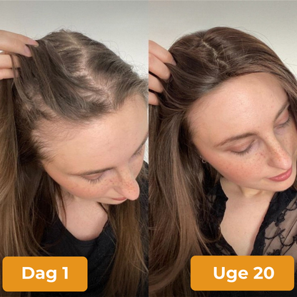 HairVita® | Græskarkerneolie-softgels