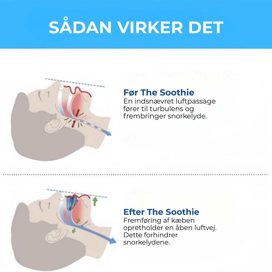 SnorkFri® | Anti-Snoring Mouthpiece Universal Size