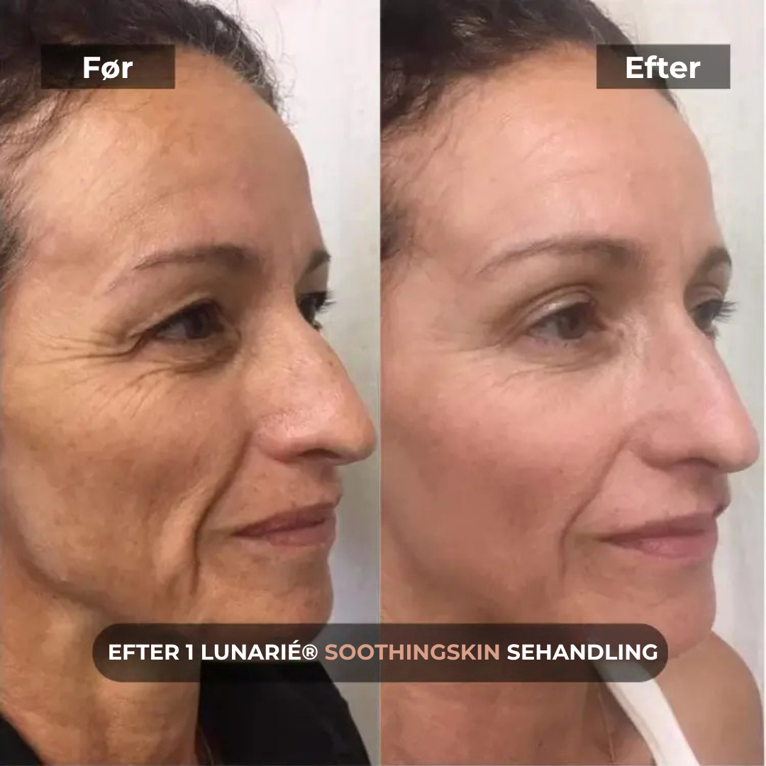 Lunarié® SoothingSkin | Glød Som Aldrig Før – Det Banebrydende Anti-Aging Gennembrud til Hjemmebrug er Her!