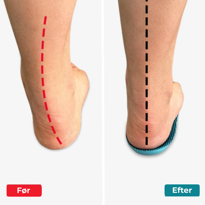FodLind® | Træt af fodsmerter? Oplev de revolutionerende FodLind® indlægssåler, der giver lindring uden medicin!