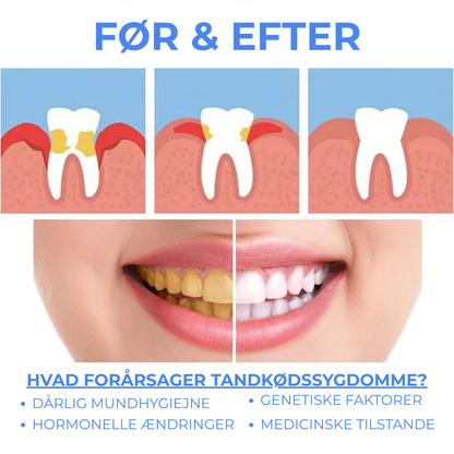 PuraGen® | Sundere tandkød og op til 95 % hvidere tænder på bare 3 dage!