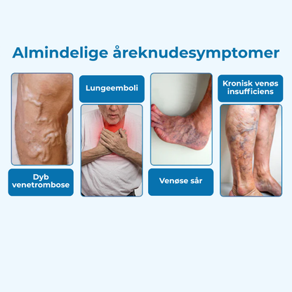 CircuClear® | Tag kontrollen over dine ben tilbage – synlig lindring på kun 1 uge