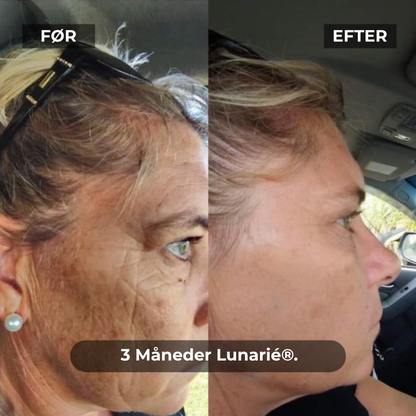 Lunarié® SoothingSkin | Glød Som Aldrig Før – Det Banebrydende Anti-Aging Gennembrud til Hjemmebrug er Her!